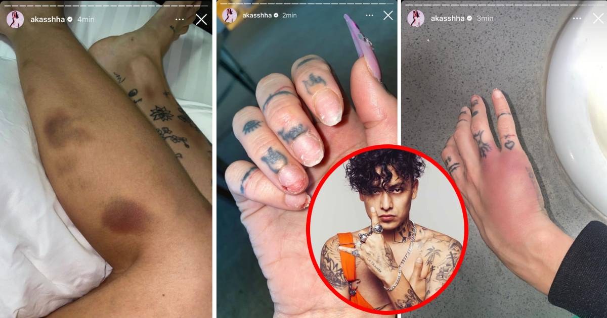 Akasha, novia del rapero Alemán, comparte fotos de golpes y audio de pelea, los internautas exigen justicia